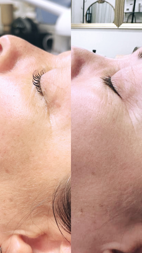 Lash Lift