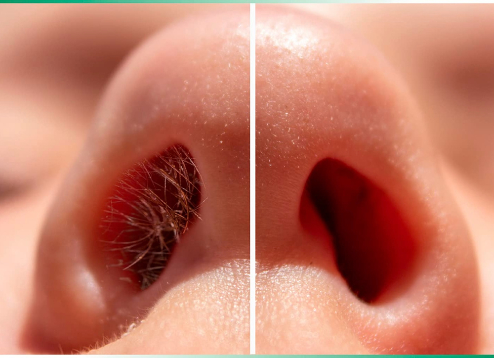 Waxing - Nose
