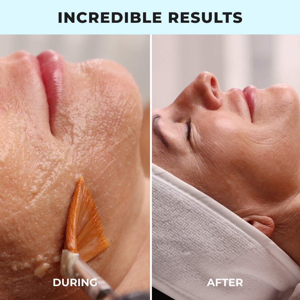 Luxe Lift Facial