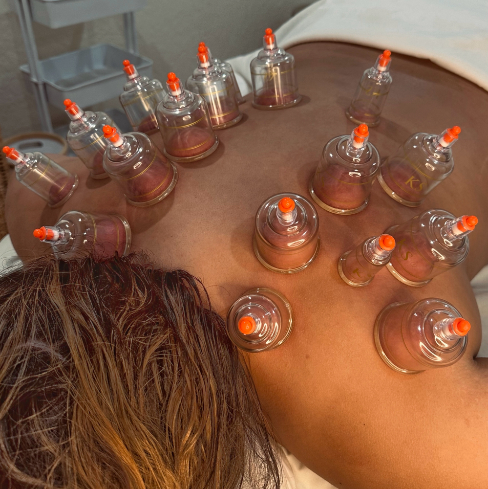 Free Cupping