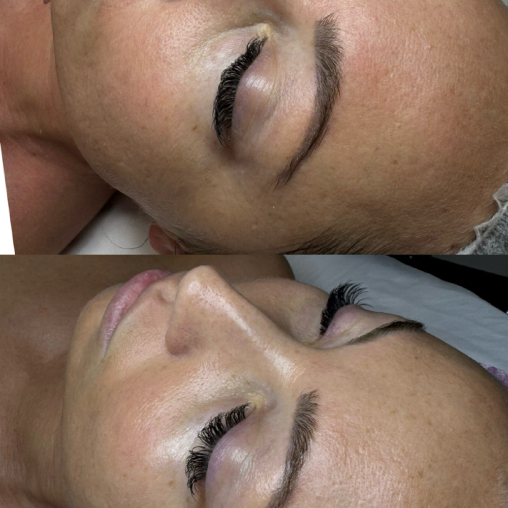 Refresh Glow Facial at Healthy skin by Alvina in Highland Park, IL