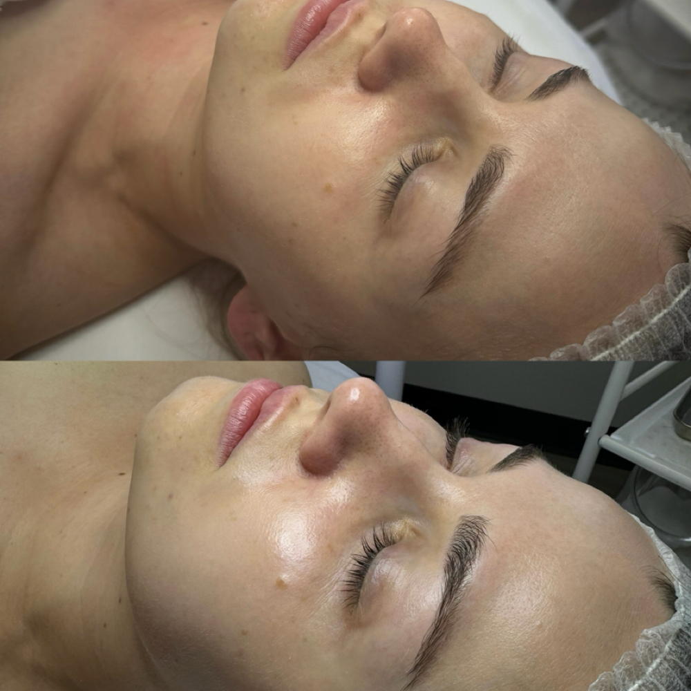 60-Min Refresh Facial at Healthy skin by Alvina in Highland Park, IL