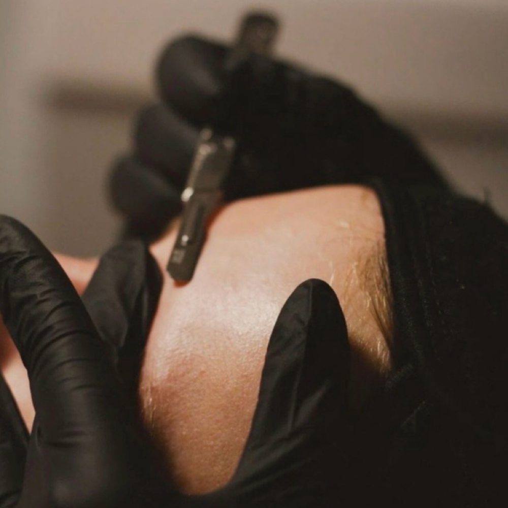 Dermaplaning at Volume Beauty Lounge in Augusta, GA