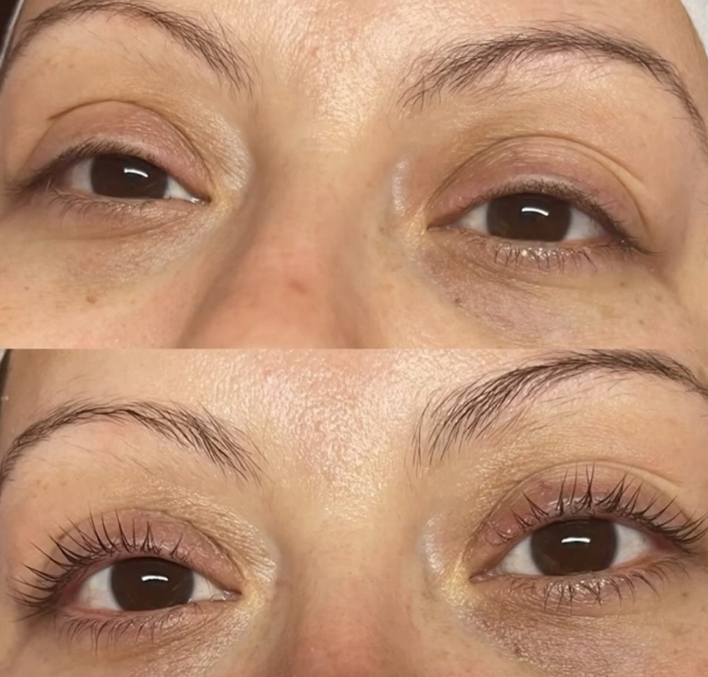 Eyelash Lift