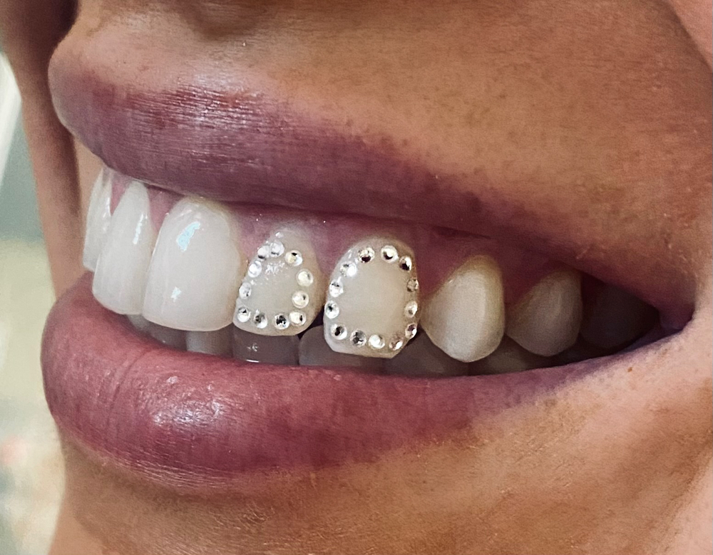 Crystal Window (single tooth) ✨ at Desert Gems Reno in Reno, NV