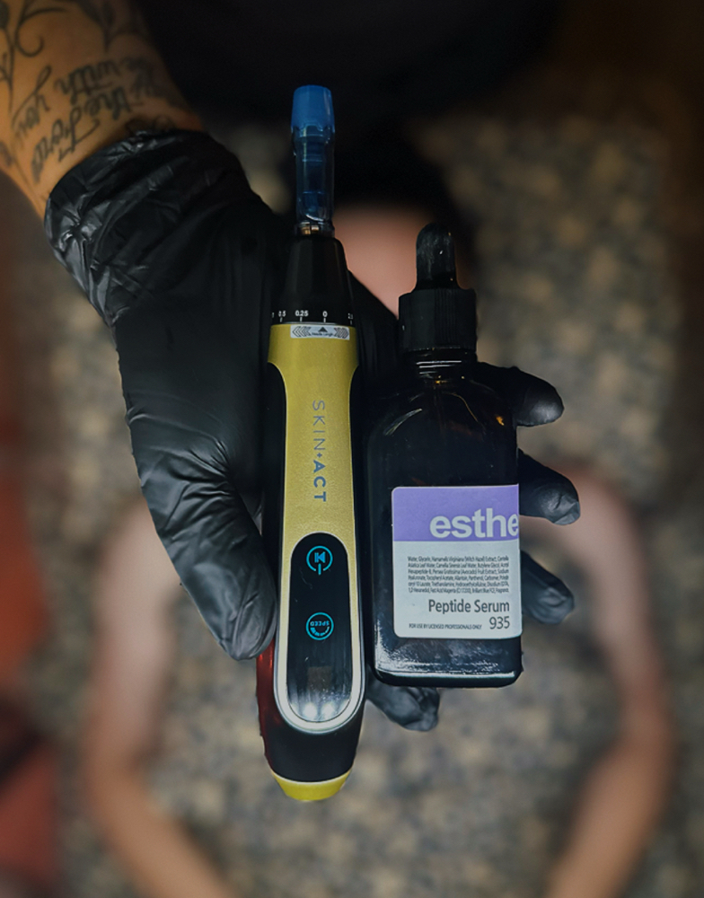 Nano Needling/Oxygen + Dermaplane