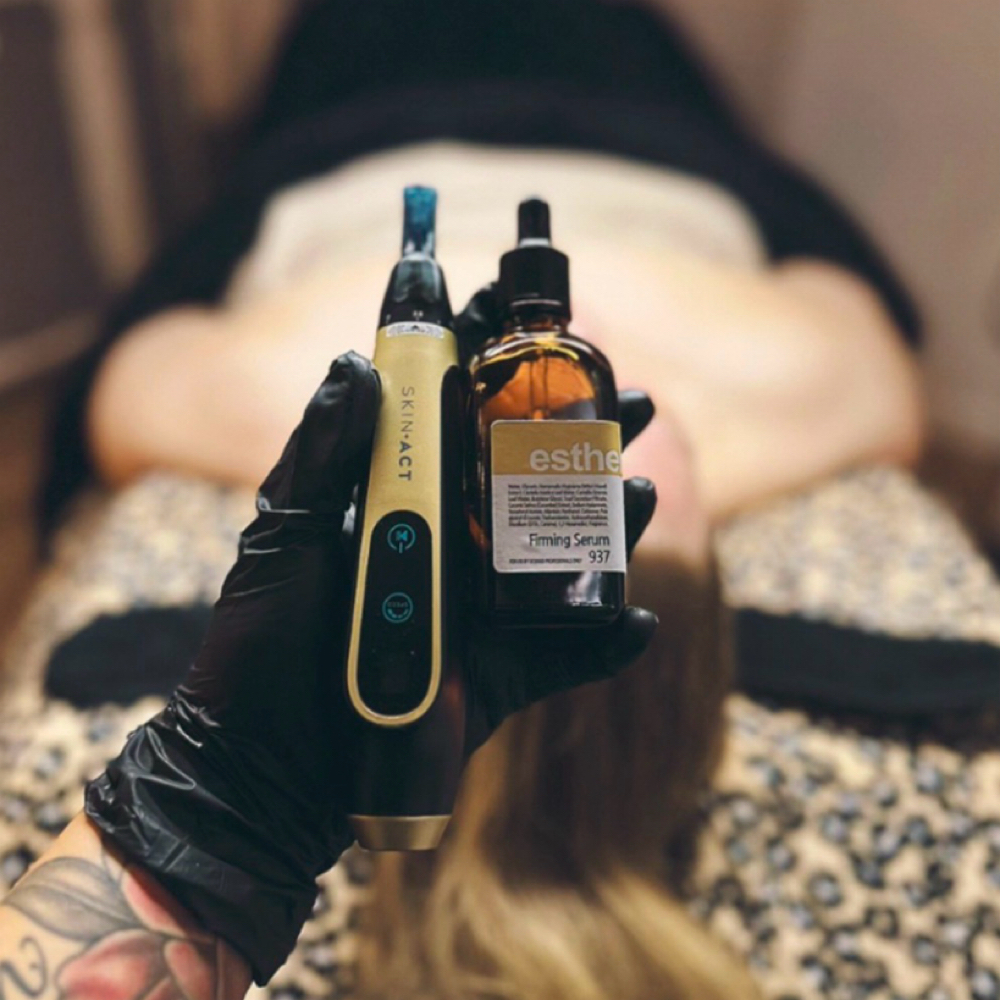 Nano Needling/Oxygen + Dermaplane at That Rose Glow in Merced, CA