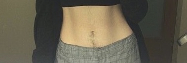 Tummy Trail