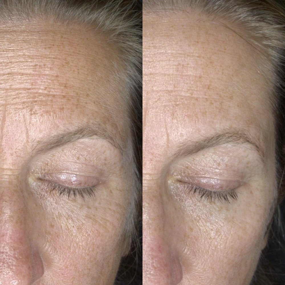 Ageless Facial at St Florian’s Soap and Spa in Coeur d’Alene, ID