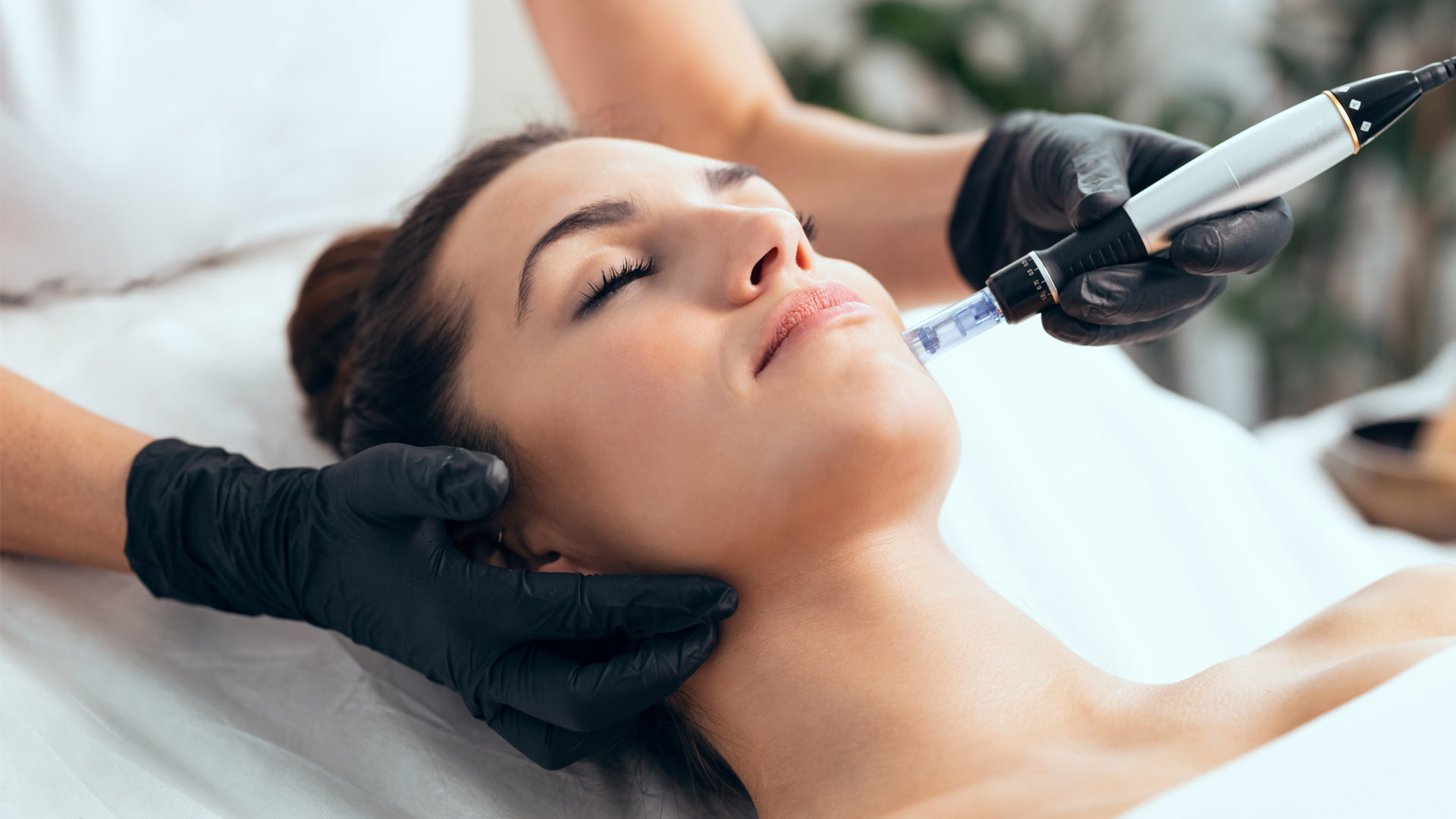 Micro-Needling Facial