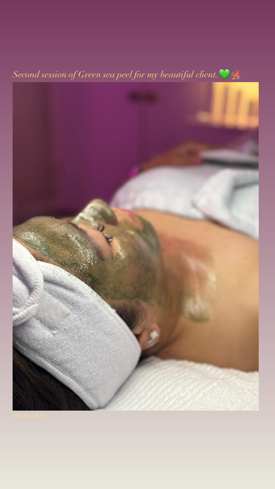 Green Sea Peel