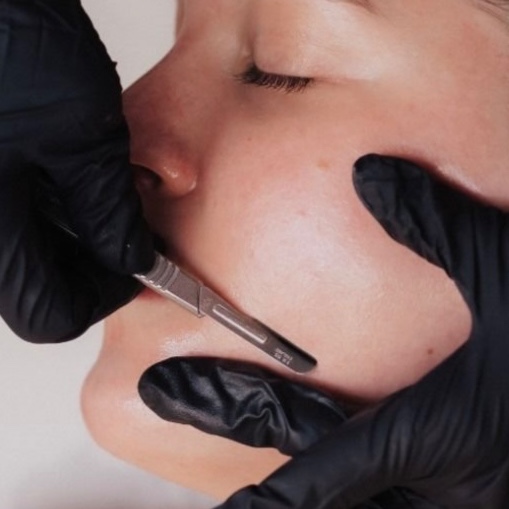 Peach Please (Dermaplane Facial) at Glow Getter Esthetics in Beulah, MI