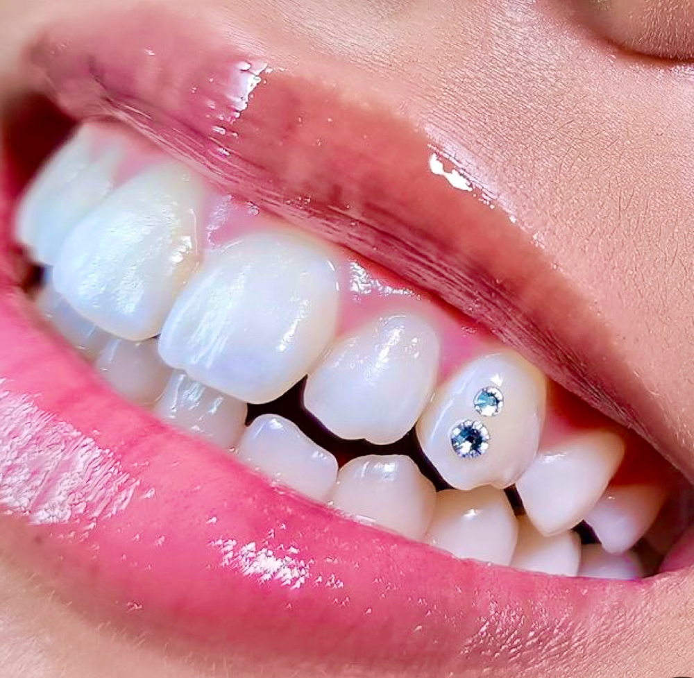 Single Tooth Gem