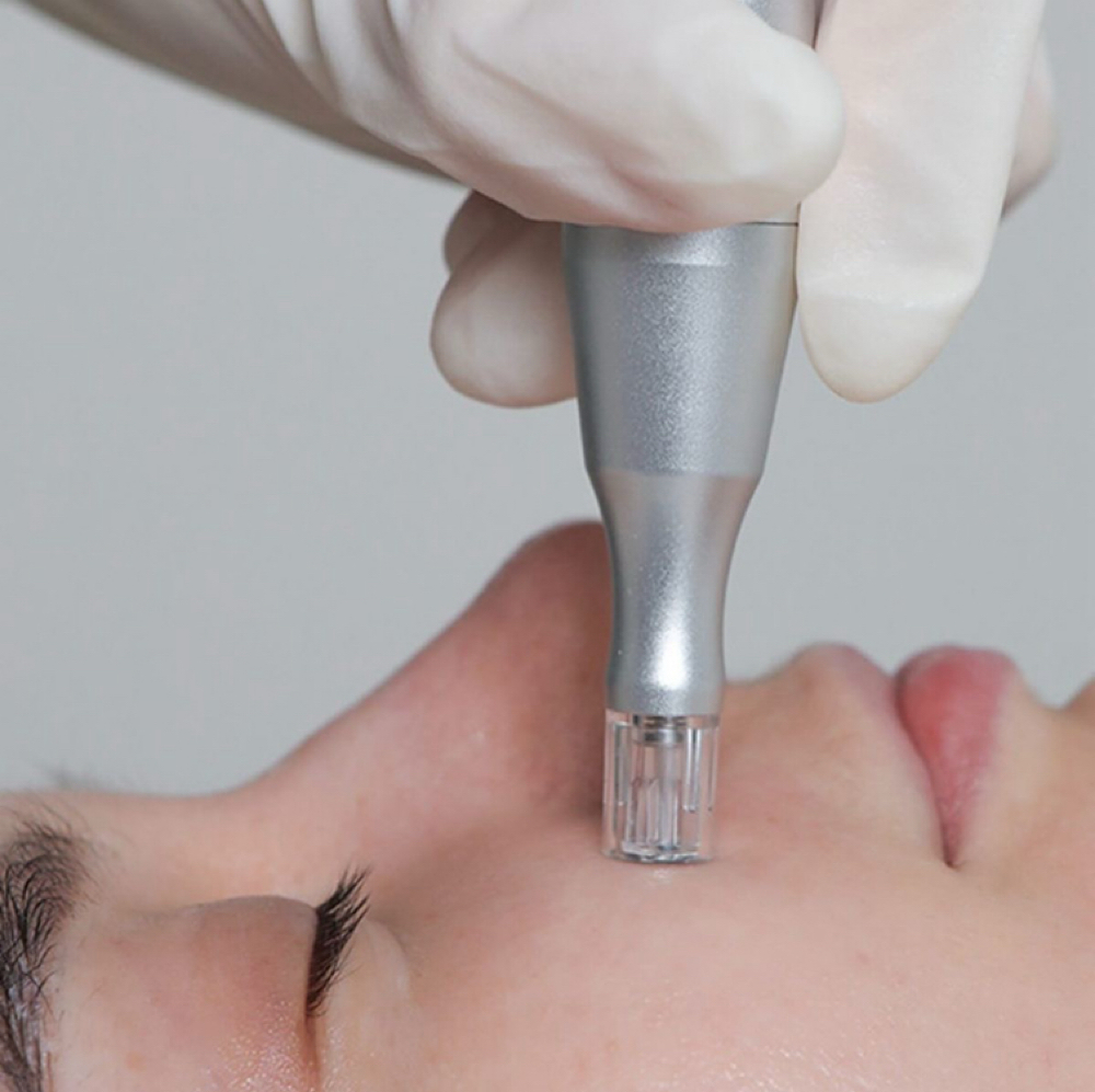 Custom Nanoinfusion Facial at Adelina Aesthetics in Old Bridge, NJ