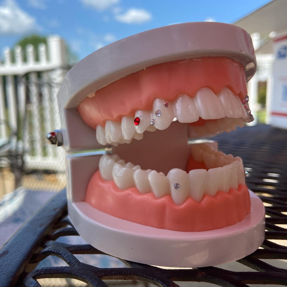 Tooth Gem