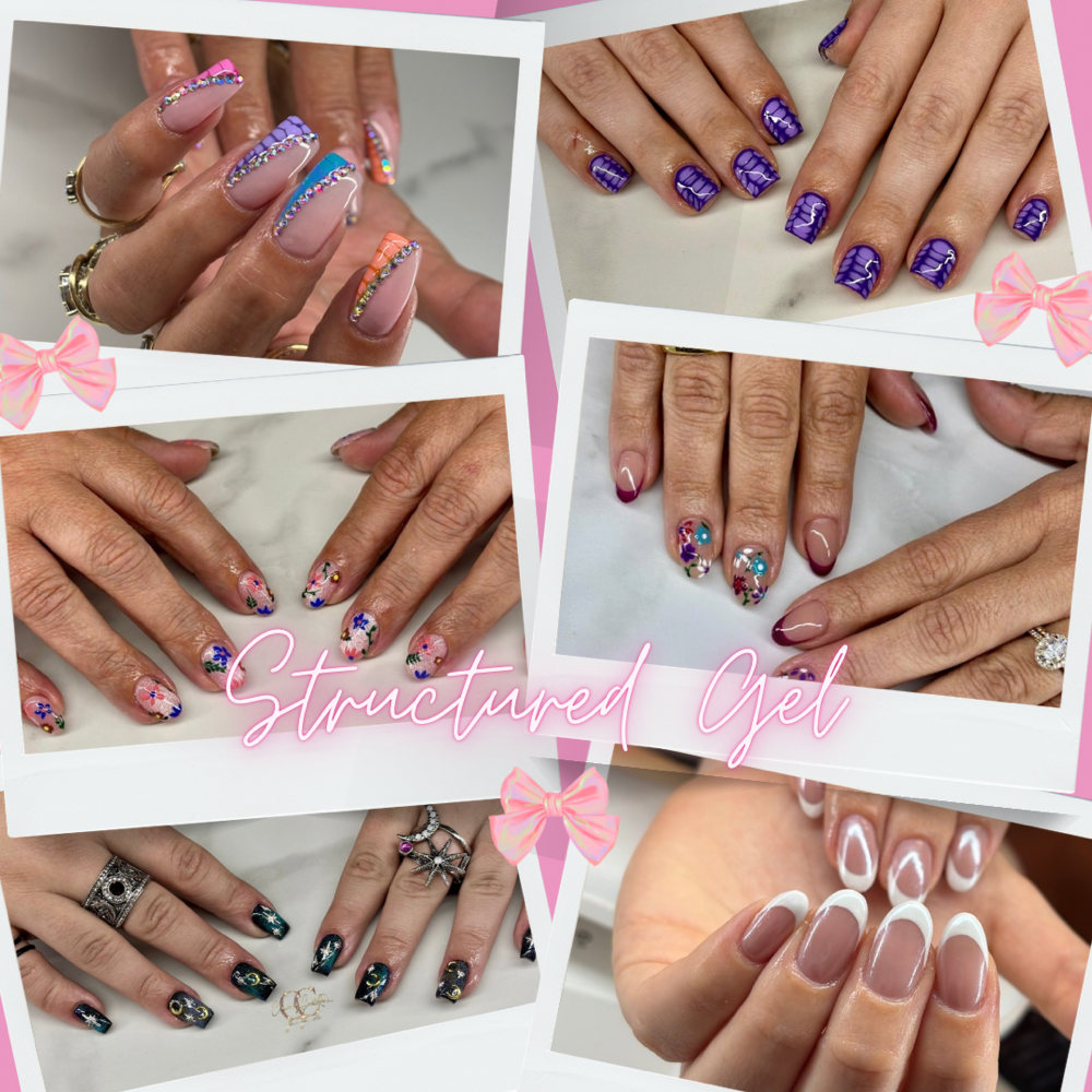 Structured Gel