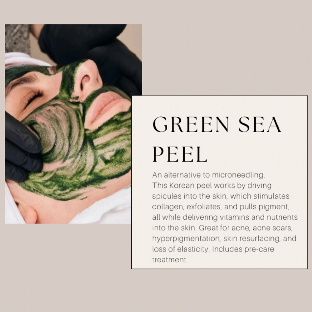 Green Sea Peel at Cozy Studio in Astoria, NY