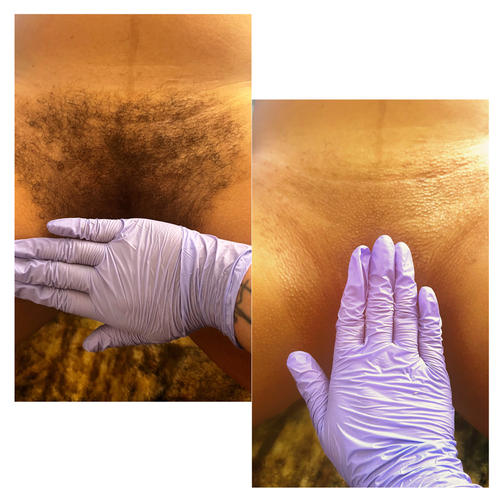 Brazilian wax