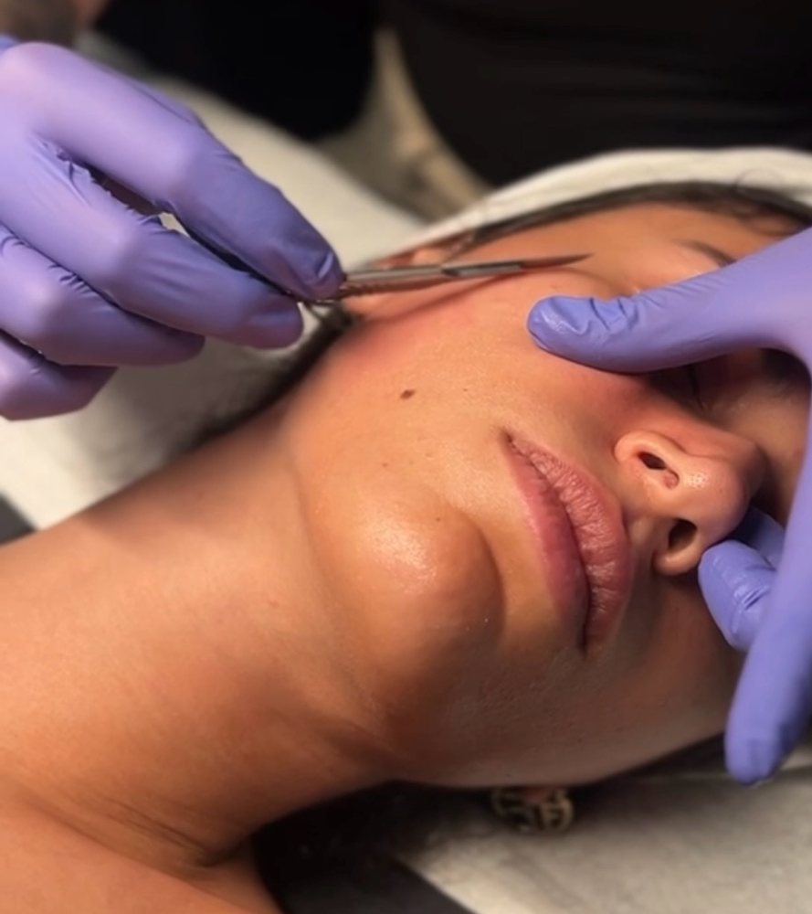 Dermaplane Facial
