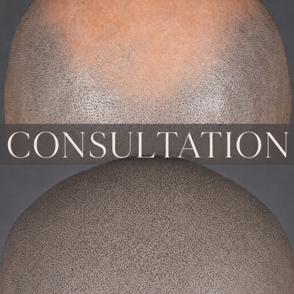 Scalp Micropigmentation Consult at NICHÉ in Lewisville, TX