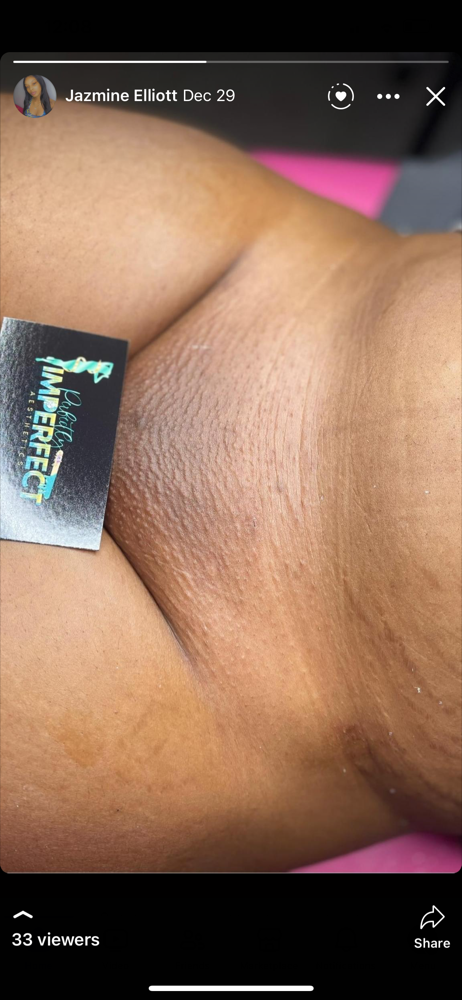 Brazilian Wax