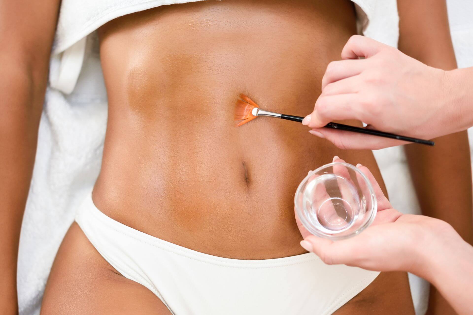 Body Chemical Peel