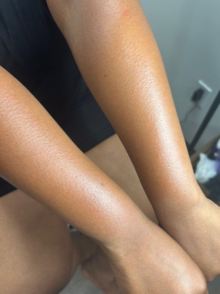 Lower Arm