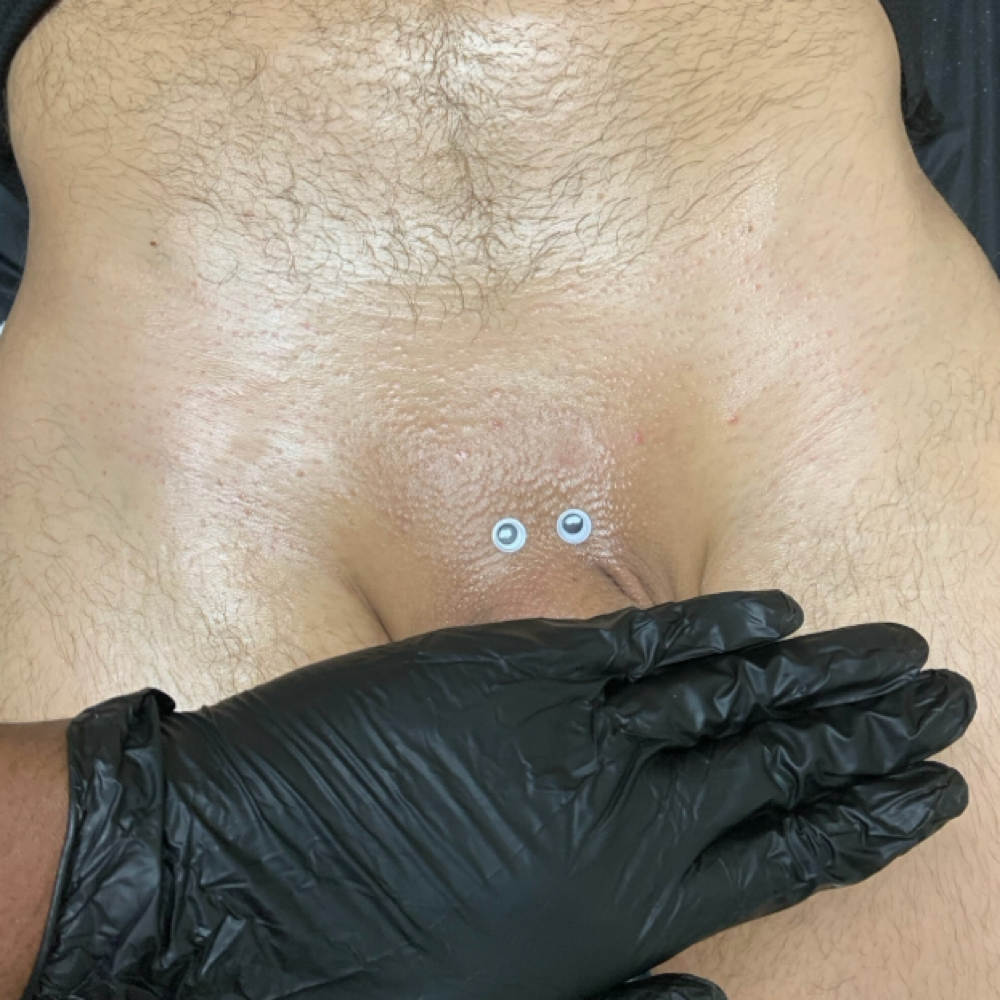 Brozilian Wax at Poshii GOAT Esthetics in Carmel, IN