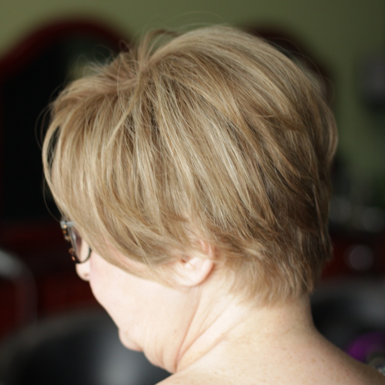 Hair Loss Solutions Consultation