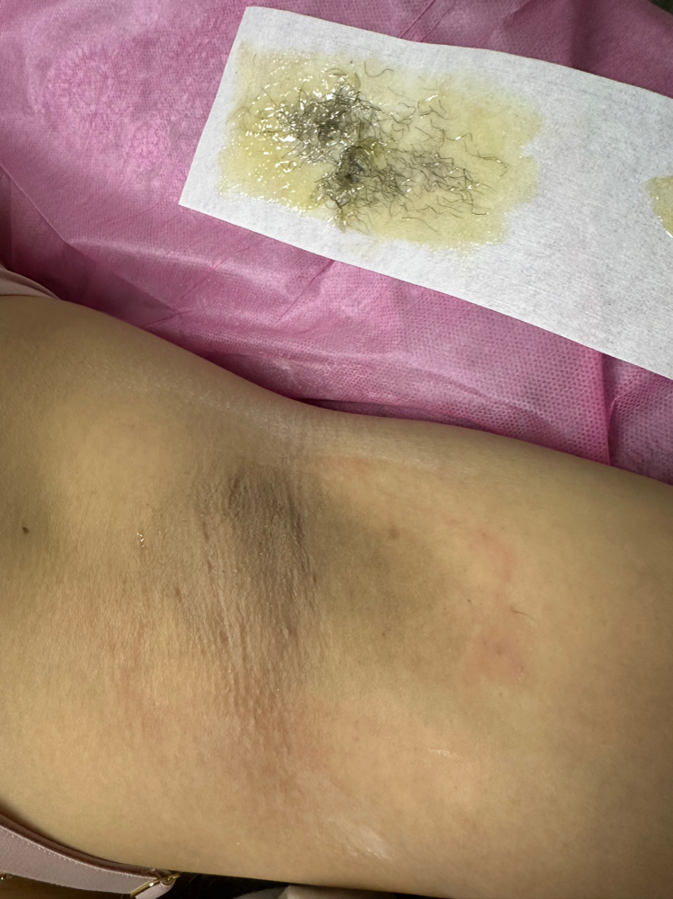 Underarm Waxing at Lisa -Skin-Therapy in Fresno, CA