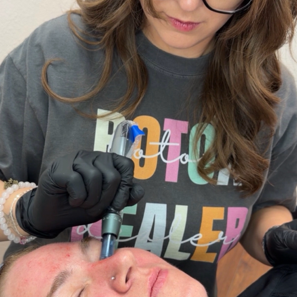 Microneedling at It's Aesthetically Jess in Swansea, IL