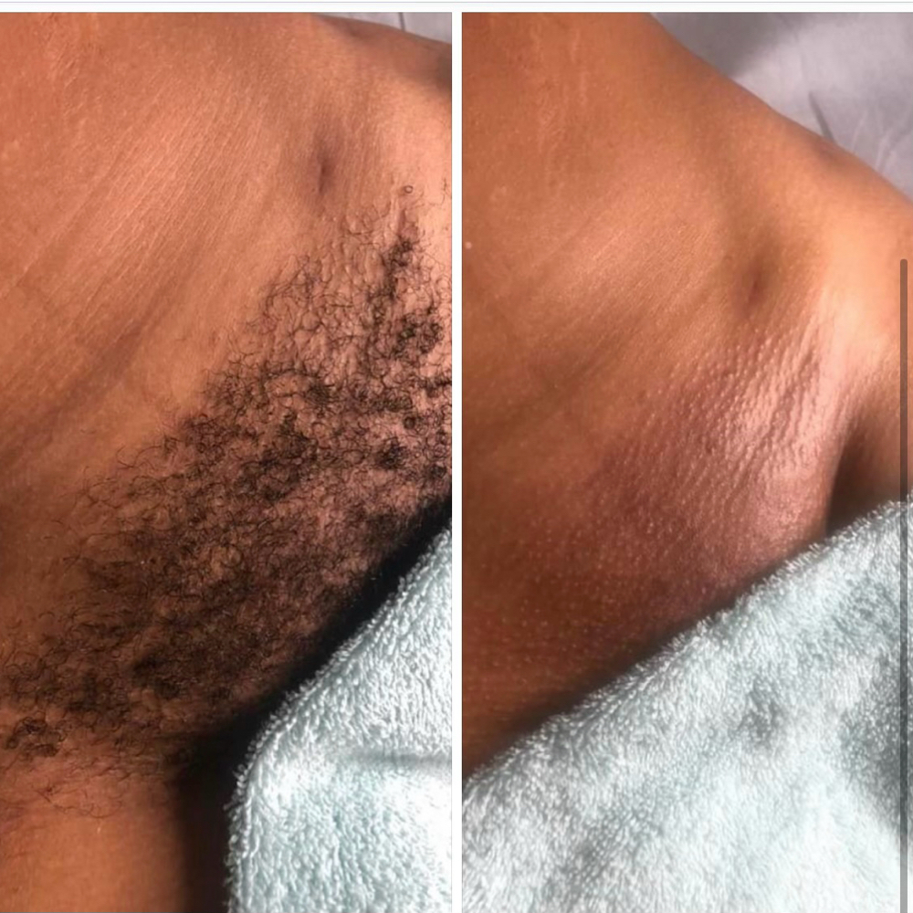Brazilian Wax at IStayReddie Beauty in Both, CA
