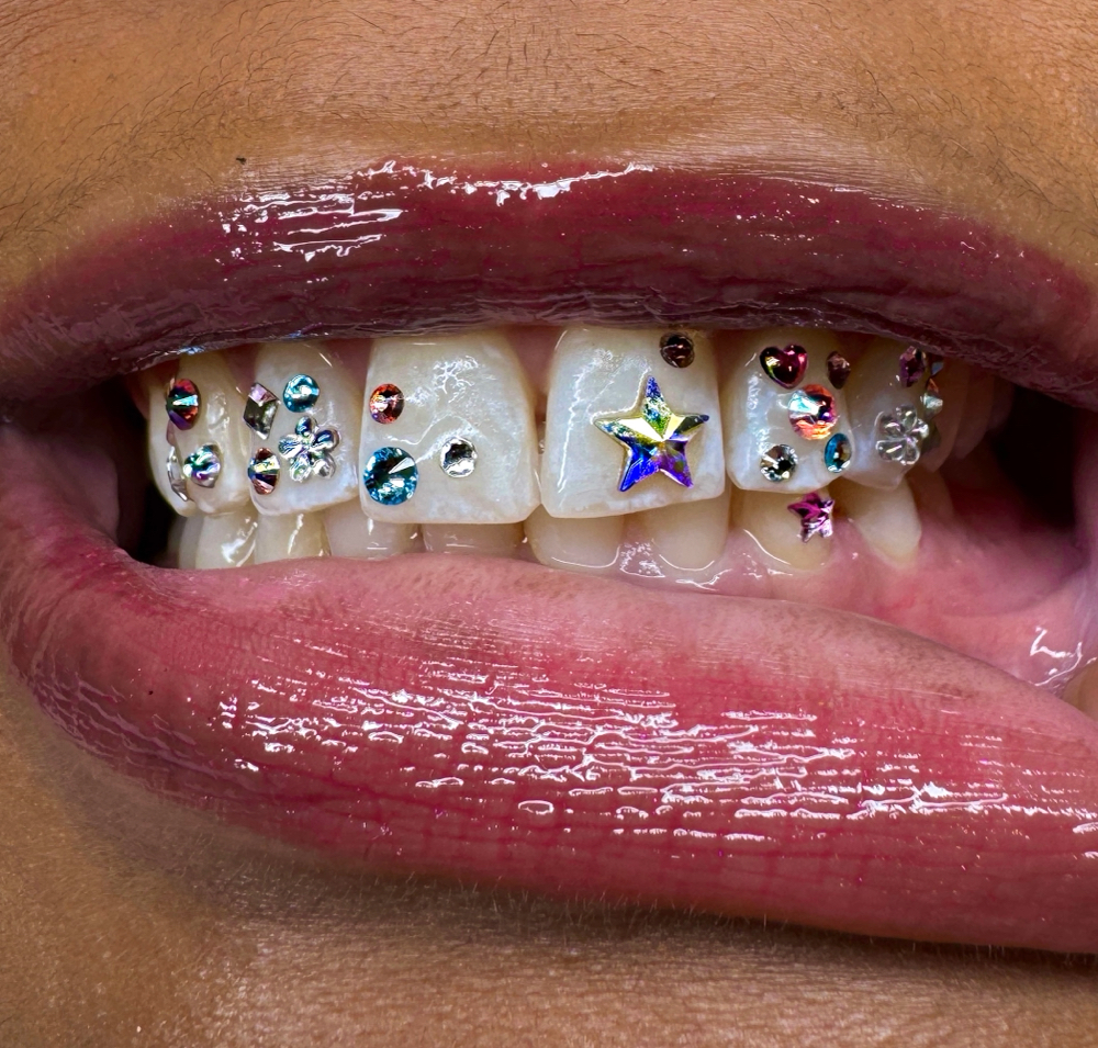 Tooth Gem Designs