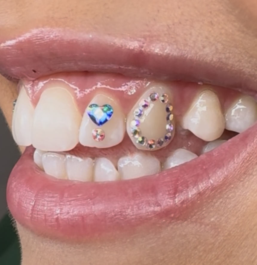 Tooth Gem Designs