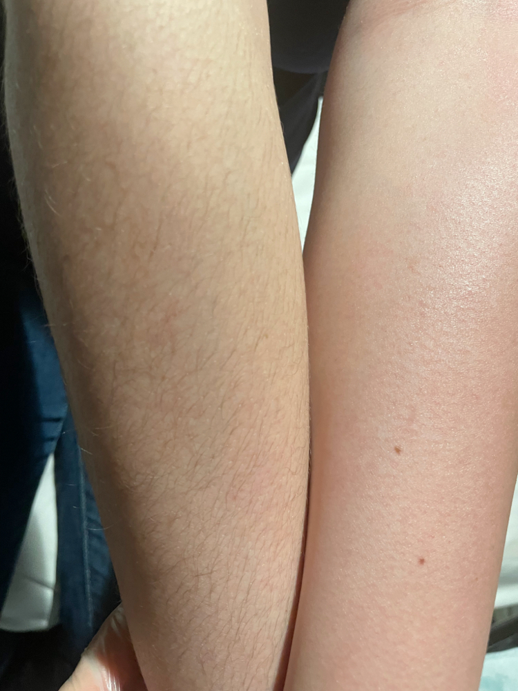 Full Arm Wax