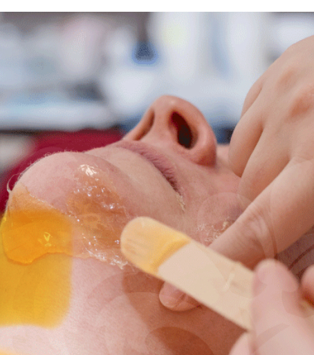 Chin and Neck Waxing