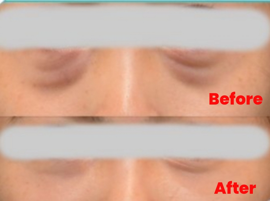 Rejuvenating Eye Treatment