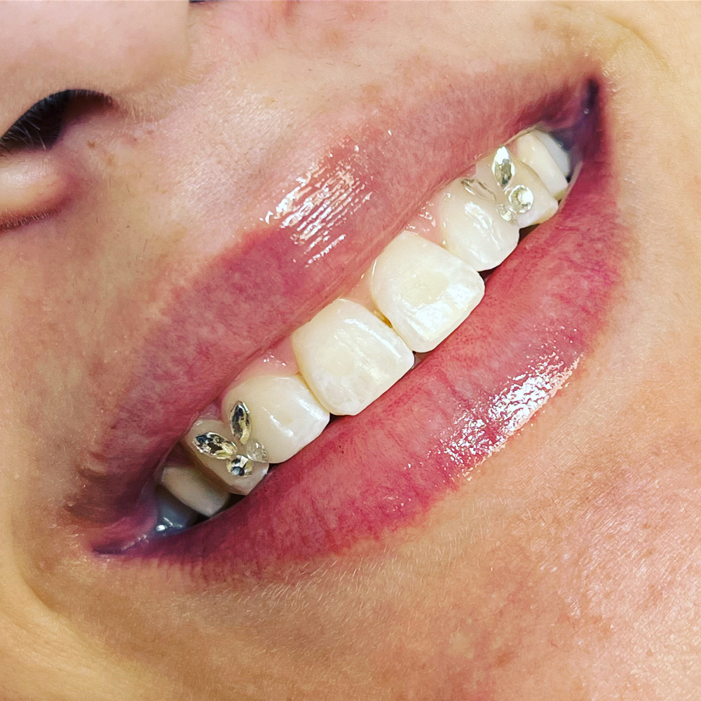 Tooth Gems