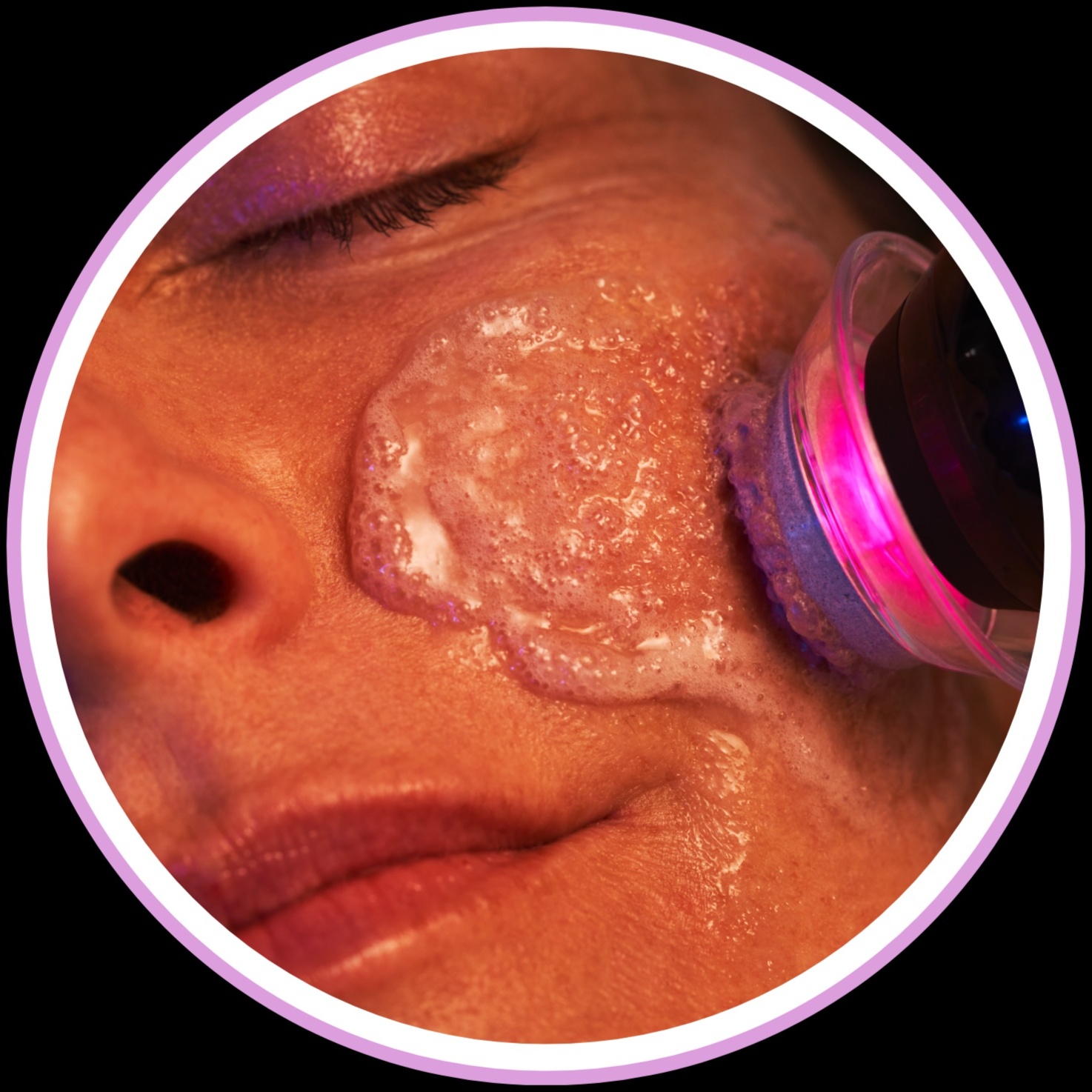 Glo2Facial /RadioFrequency -BRIGHT at FaceMe Skin Care in Bloomingdale, IL