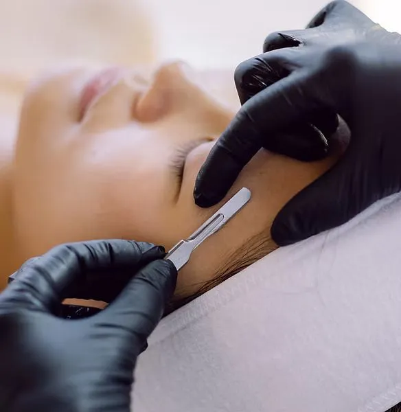 Dermaplaning