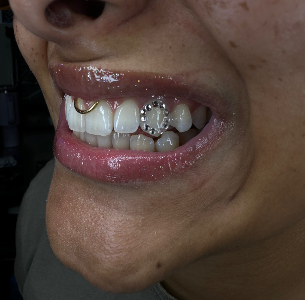 Window Tooth Gems