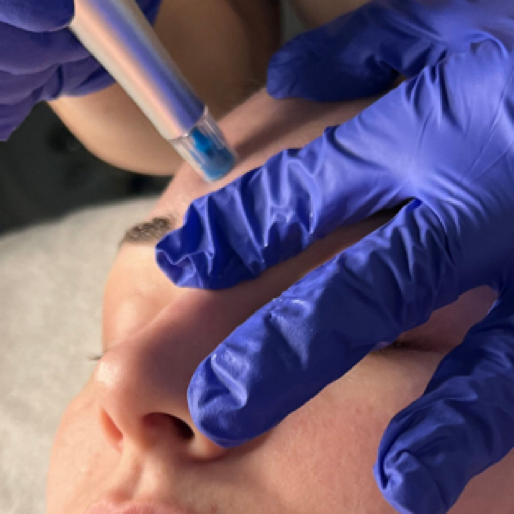 ReZenerate Nano Facial