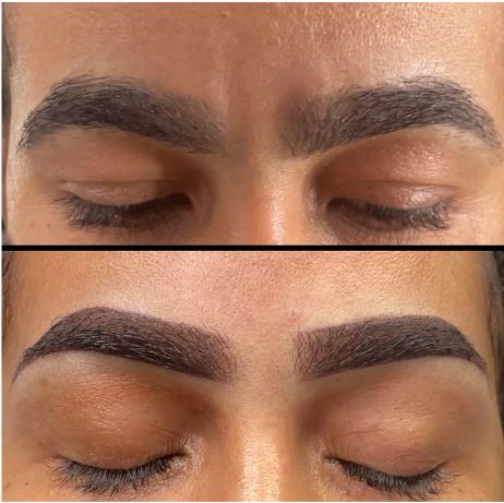 Eyebrows Micropigmentation