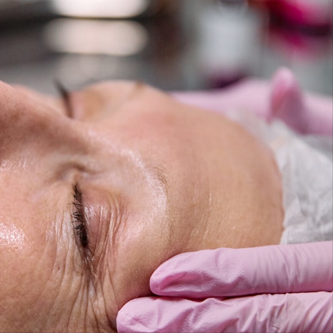 Anti-Aging Facial at FaceMe Skin Care in Bloomingdale, IL