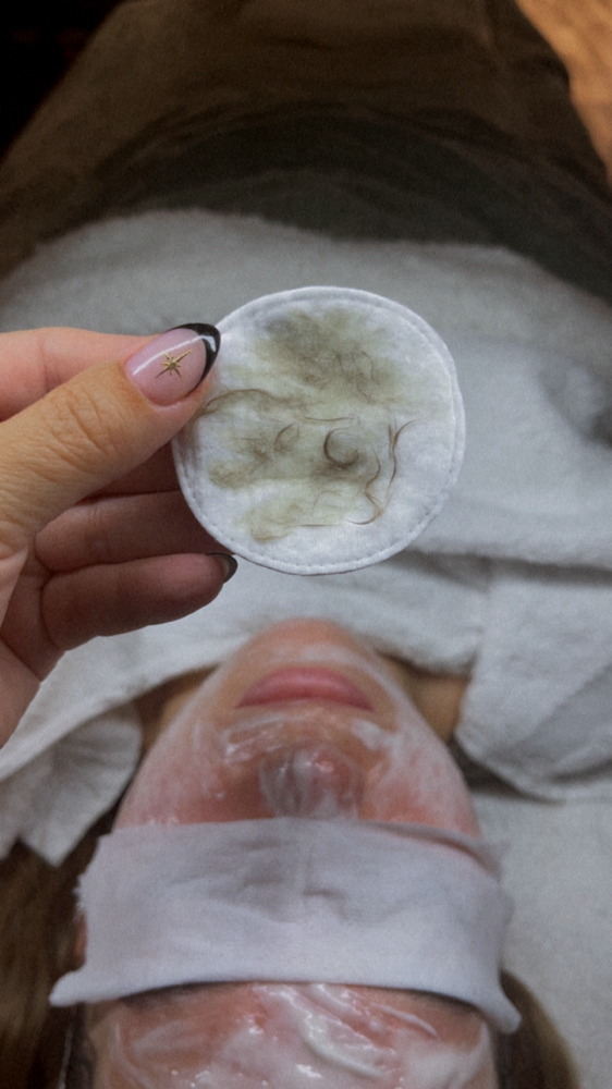 Dermaplane Add On