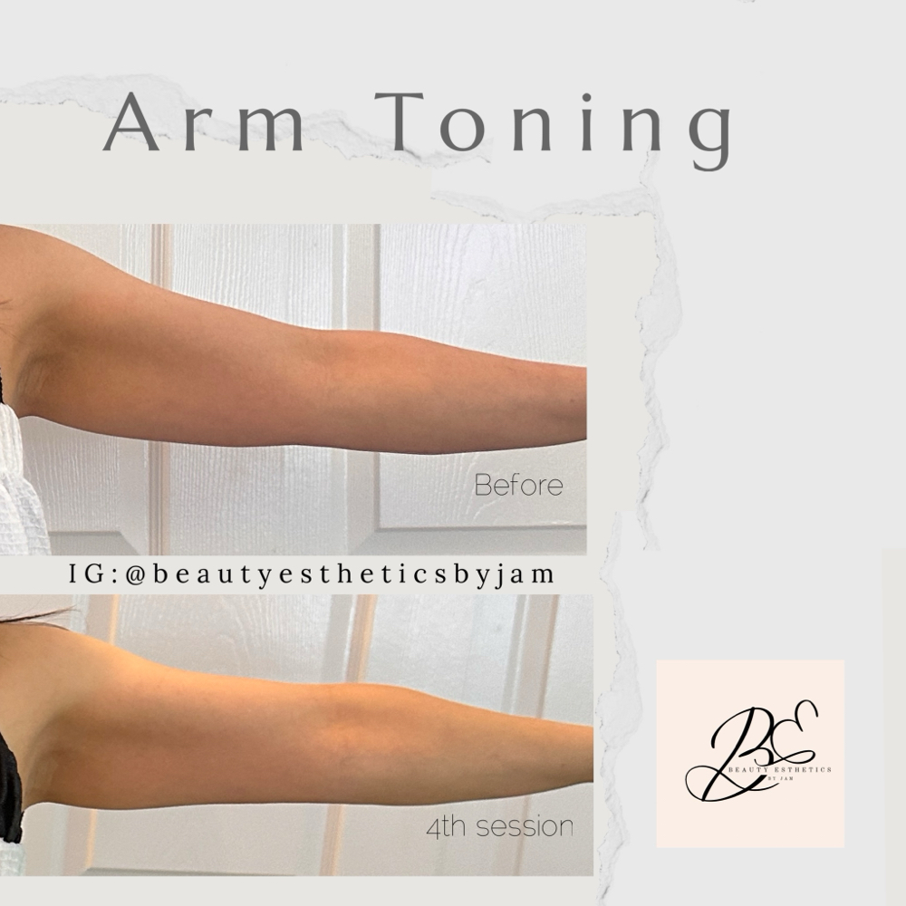 Arm Toning Buy3Get1
