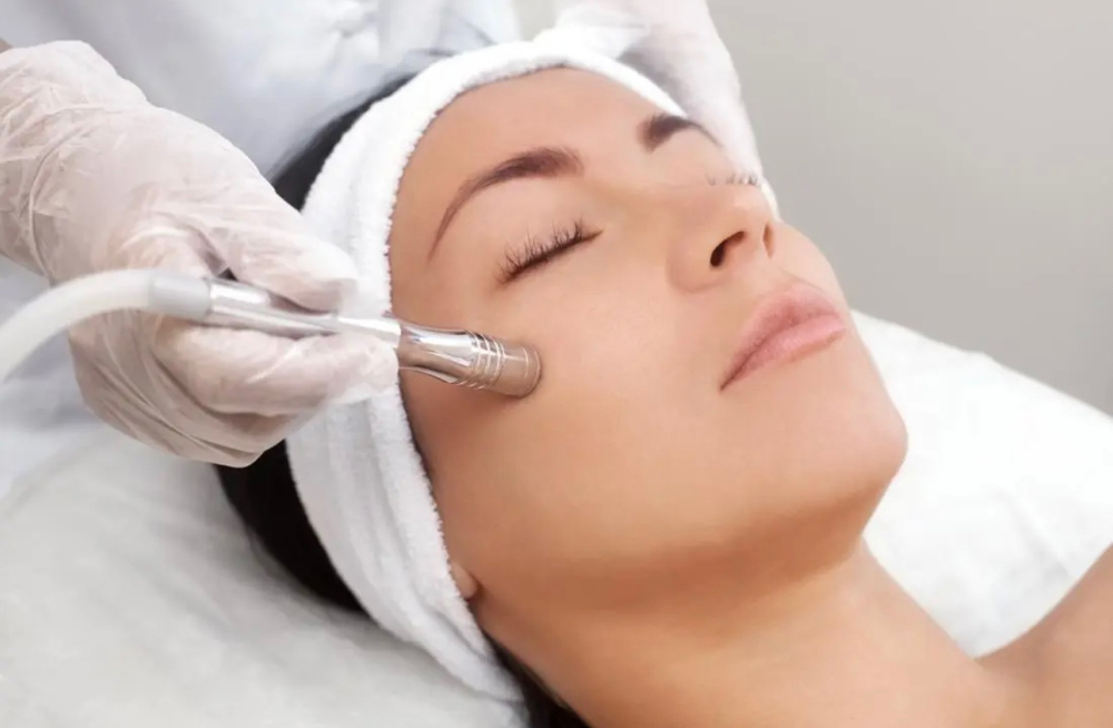 Microdermabrasion Facial