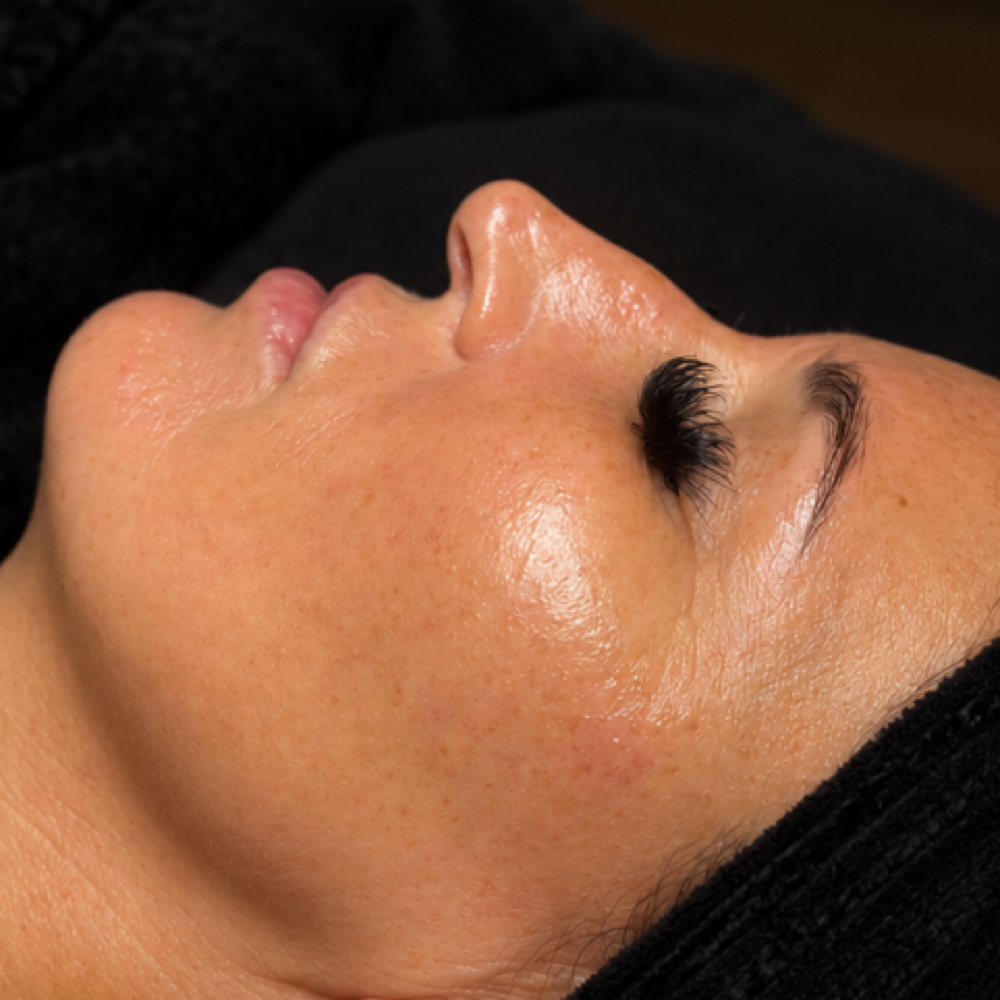 SHED THE DEAD | October Special at Mindful Medical Spa LLC in Anniston, AL