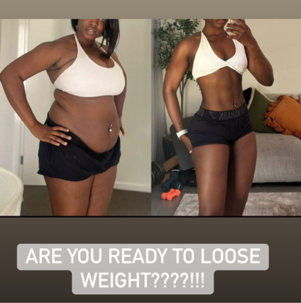 Medical Weight Loss Program (Tirzep at Flawless Spa & Beauty in Fort Worth, TX