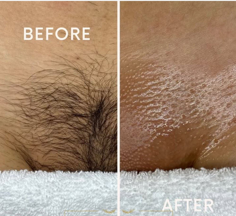 Bikini Wax